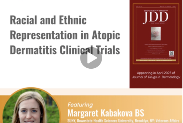 Journal of Drugs in Dermatology JDD Article About Video Abstract For Racial and Ethnic Representation in Atopic Dermatitis Clinical Trial.